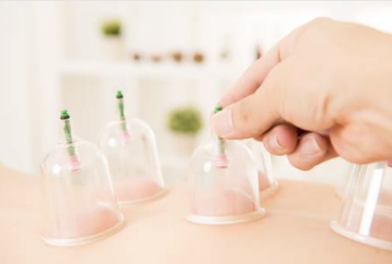 Cours de Hijama et de Sangsue