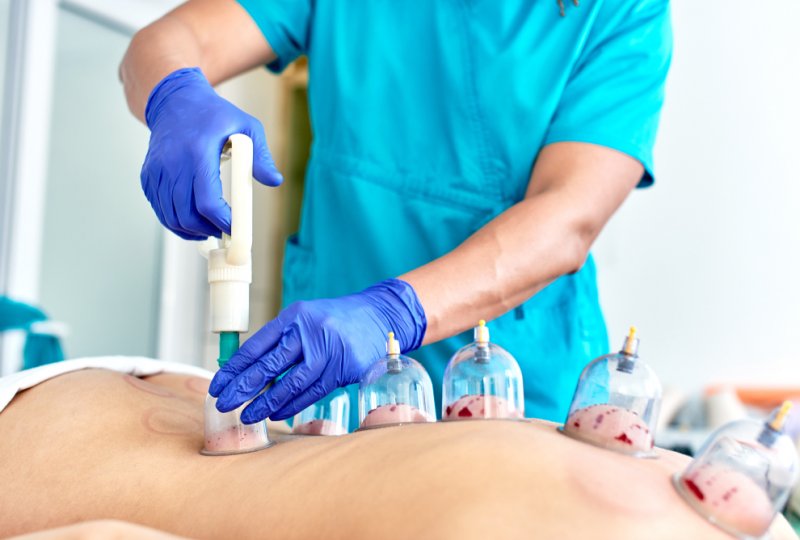 Formation De Hijama Pratique